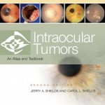 Intraocular Tumors: An Atlas and Text, 2nd Edition