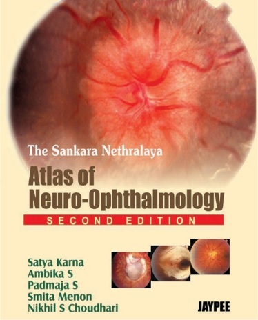 The Sankara Nethralaya Atlas of Neuro Ophthalmology