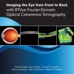 Imaging the Eye from Front to Back with RTVue Fourier-Domain Optical Coherence Tomography