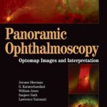 Panoramic Ophthalmoscopy: Optomap? Images and Interpretation