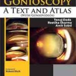 Gonioscopy: A Text and Atlas (with Goniovideos)
