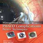 Management of PHACO Complications: Newer Techniques
