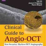 Clinical Guide to Angio-OCT (Non Invasive, Dyeless OCT Angiography)