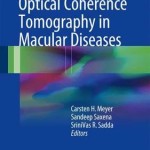 Spectral Domain Optical Coherence Tomography in Macular Diseases 2016