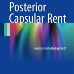 Posterior Capsular Rent 2016 : Genesis and Management