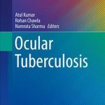 Ocular Tuberculosis