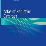 Atlas of Pediatric Cataract