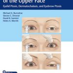 Ophthalmic Plastic Surgery of the Upper Face : Eyelid Ptosis, Dermatochalasis, and Eyebrow Ptosis