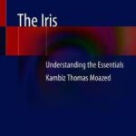 The Iris : Understanding the Essentials