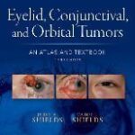 Eyelid, Conjunctival, and Orbital Tumors: An Atlas and Textbook