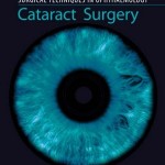 Surgical Techniques in Ophthalmology Series: Cataract Surgery, 1e