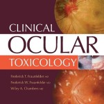 Clinical Ocular Toxicology: Drug-Induced Ocular Side Effects