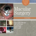 Macular Surgery, 2nd Edition