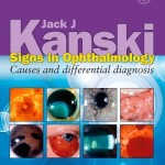 Signs in Ophthalmology: Causes and Differential Diagnosis Expert Consult – Online and Print