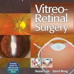 Complications of Vitreo-Retinal Surgery Retail PDF