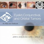 Eyelid, Conjunctival, and Orbital Tumors: An Atlas and Text, 2nd Edition