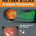 Retina Atlas: A Global Perspective