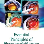 Essential Principles of Phacoemulsification