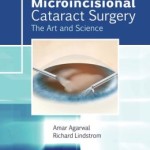 Microincisional Cataract Surgery: The Art and Science