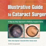 Illustrative Guide to Cataract Surgery: A Step-by-Step Approach to Refining Surgical Skills