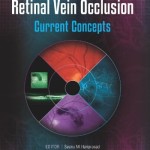 Management of Retinal Vein Occlusion: Current Concepts