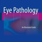 Eye Pathology: An Illustrated Guide