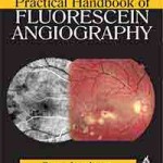 Practical Handbook of Fluorescein Angiography