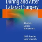 Complications During and After Cataract Surgery: A Guide to Surgical Management
