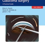Minimally Invasive Glaucoma Surgery: A Practical Guide