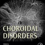 Choroidal Disorders