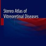 Stereo Atlas of Vitreoretinal Diseases