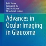 Advances in Ocular Imaging in Glaucoma