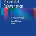 Periorbital Rejuvenation : A Practical Manual