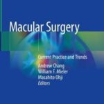 Macular Surgery : Current Practice and Trends