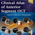 Clinical Atlas of Anterior Segment OCT: Optical Coherence Tomography